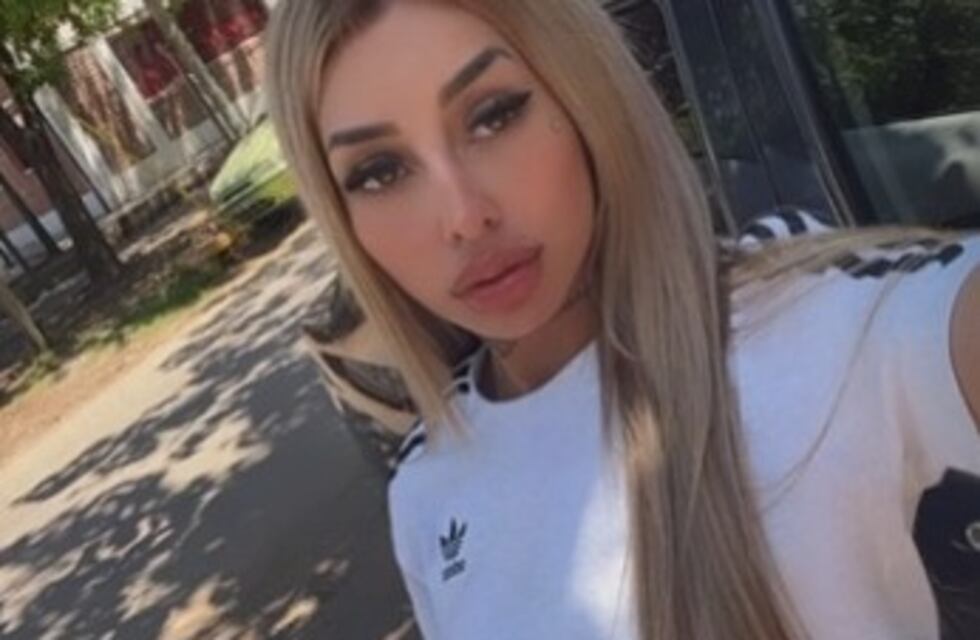 “Lip wings”, la tendencia para tener los labios de una “Bratz” y que Tamara Báez parece dominar