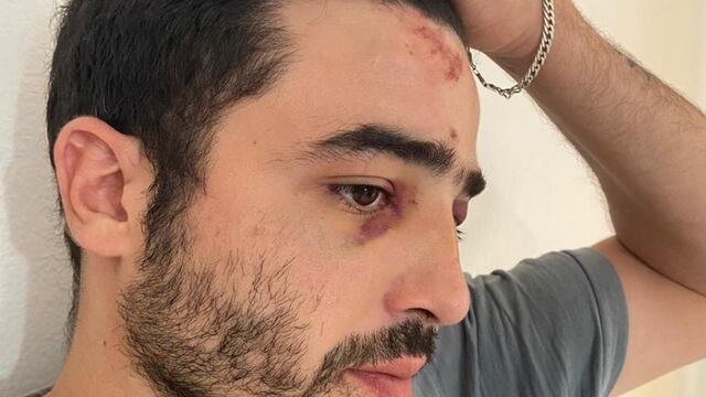 El verdulero fue agredido durante una marcha del Suoem a comienzos de noviembre.