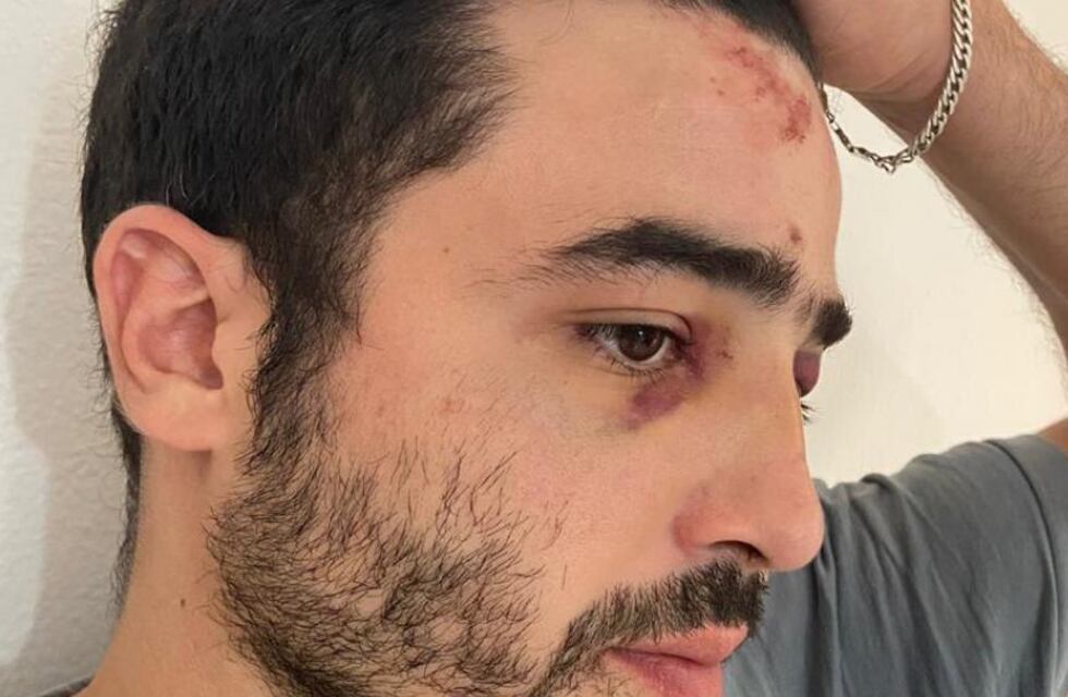 La Municipalidad de Córdoba suspendió a tres empleados por agresión