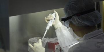 "Hongo negro". Alertan por la llegada de mucormicosis a la Argentina. (Ministerio de Salud)