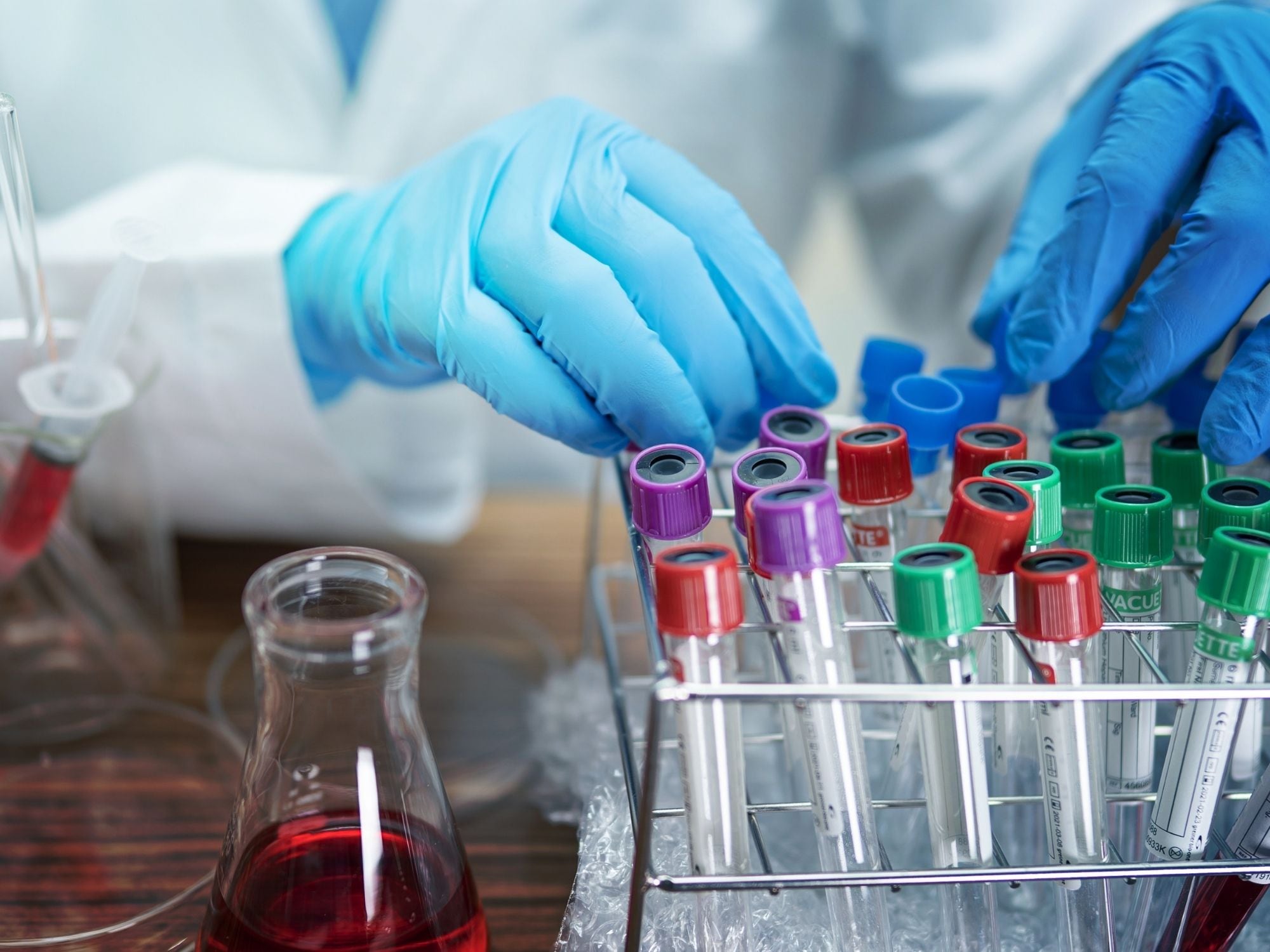 Cómo es el test que revela tus orígenes y si sos propenso a diabetes, cáncer o problemas cardíacos