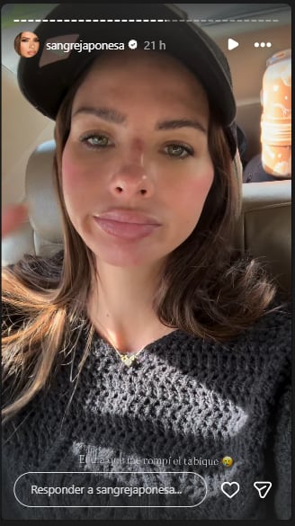 La China Suárez mostró el accidente que tuvo cuando grababa su serie en la Patagonia