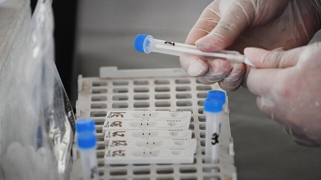 Muestras de hisopados para detectar el Covid-19. Foto: Jose Gutierrez