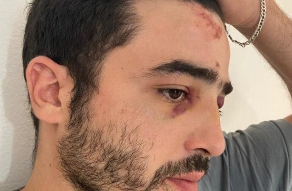 Pide que echen a los municipales que lo habrían golpeado