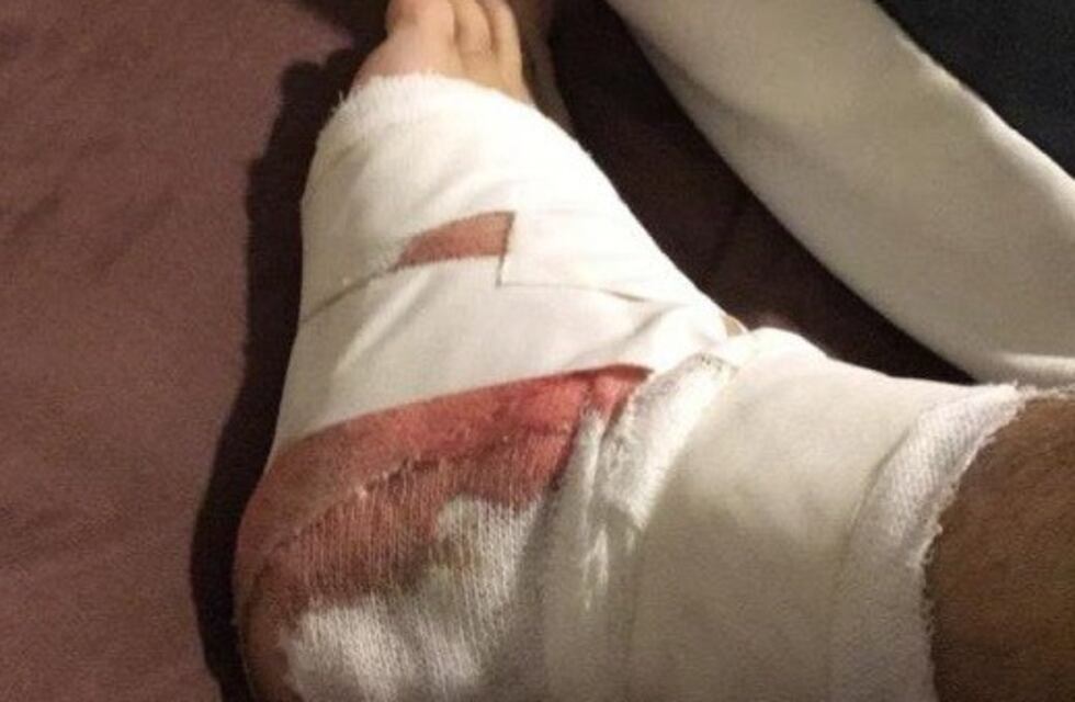 Palometas fuera de temporada: joven atacado cuando hacía kitesurf en el Paraná