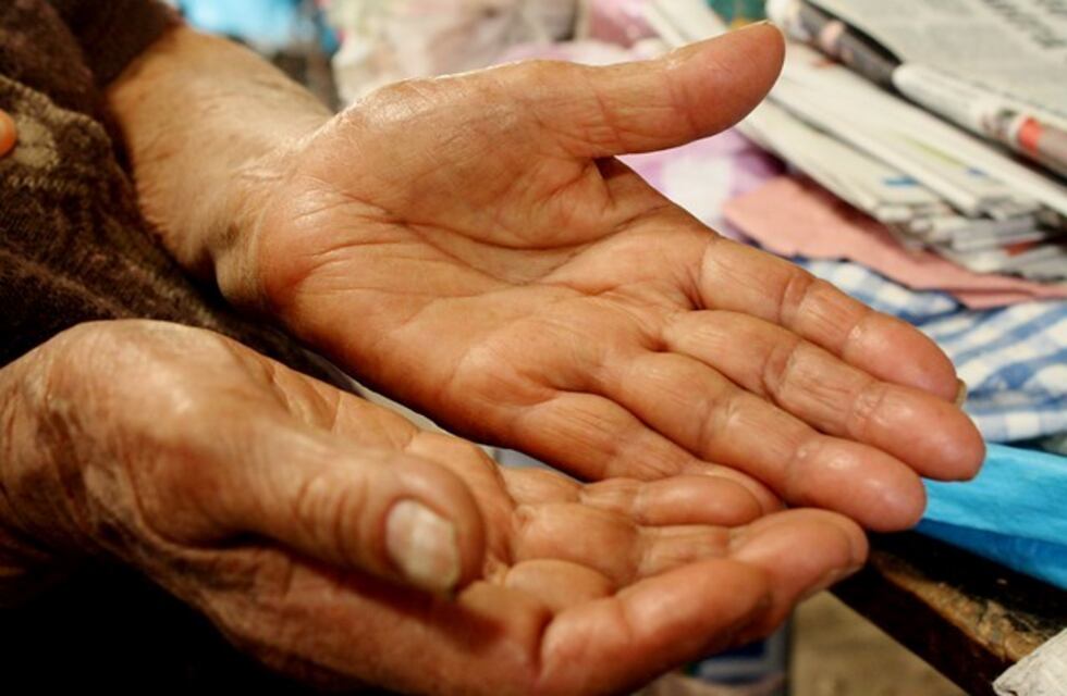 Una jujeña no tenía huellas dactilares y no podía acceder a un DNI