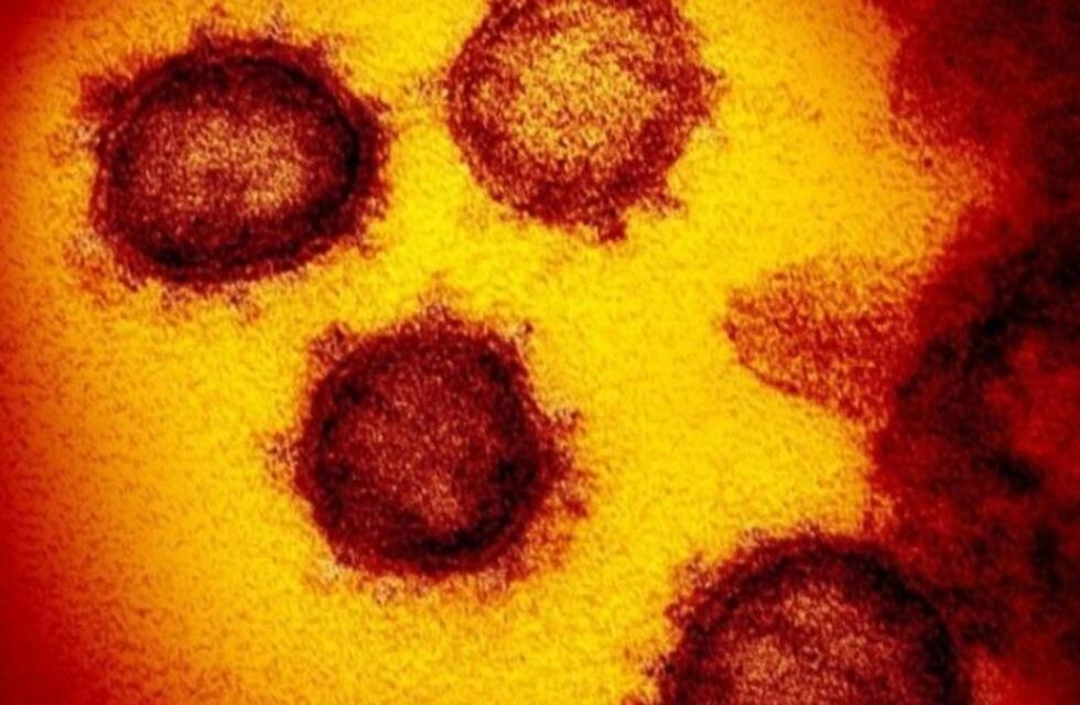 Son tres los casos sospechosos de coronavirus en el Chaco