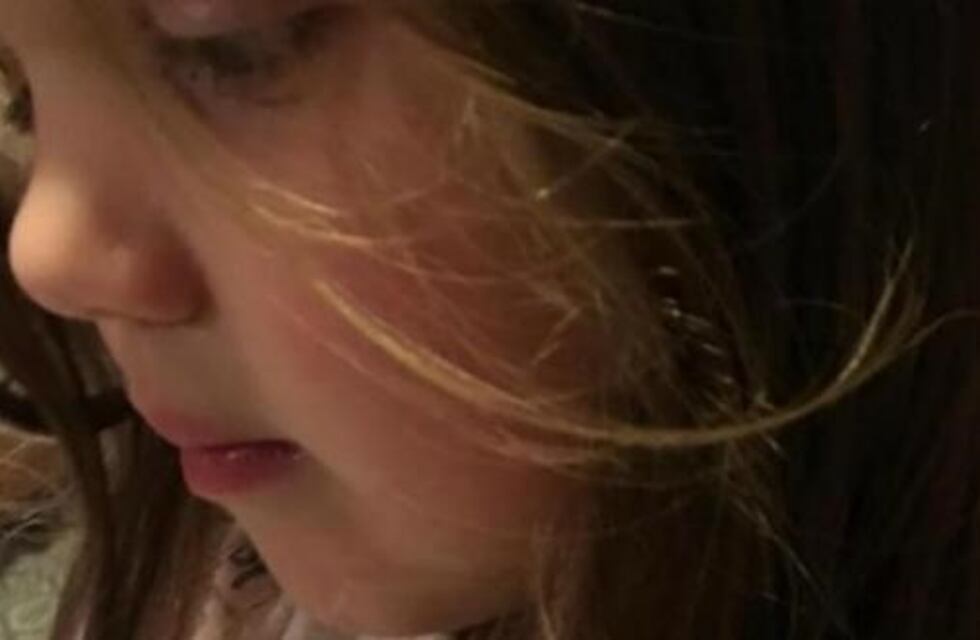 Su hija vino con un chicle pegado en el pelo y él lo resolvió de la forma más polleruda