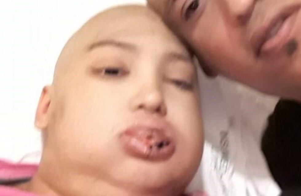San Juan: piden ayuda para una joven mamá con leucemia