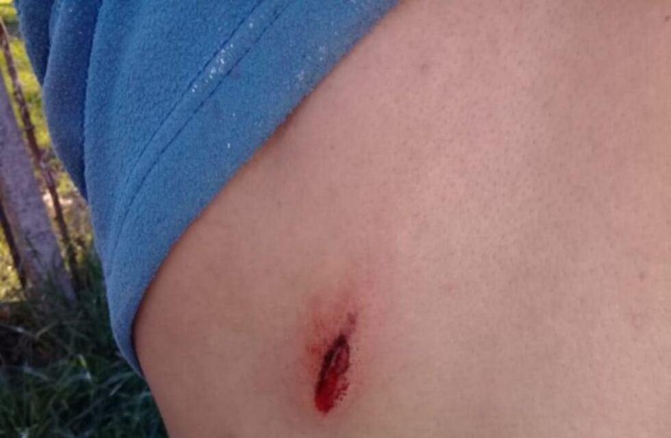 Un hombre fue detenido por el ataque a tiros a empleados municipales