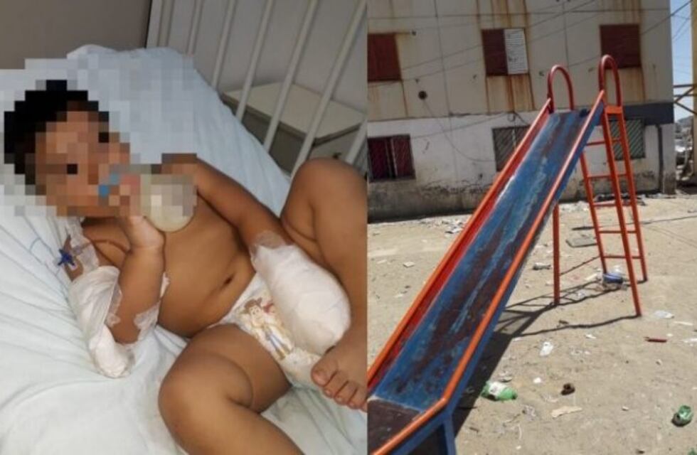 Un pequeño perdió el dedo índice en un juego de la plaza de las "1008"