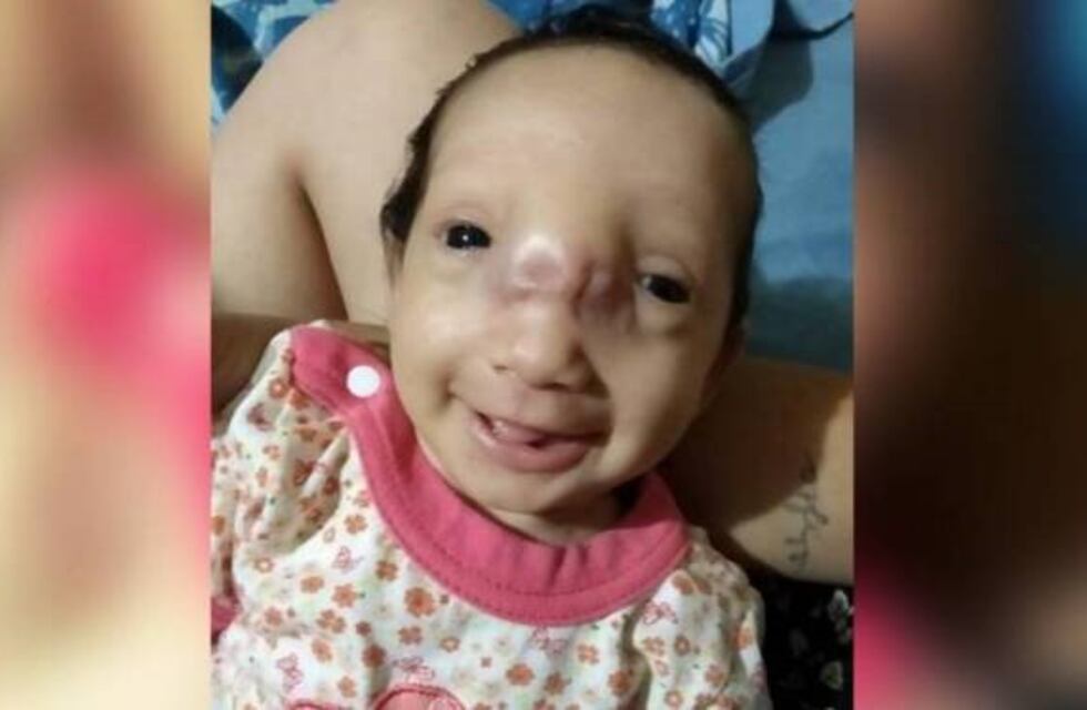 Una bebé bahiense necesita ayuda para operarse en Buenos Aires