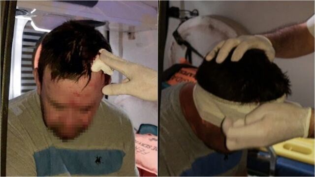 Hombre lesionado en Concepción del Uruguay\nCrédito: 3442