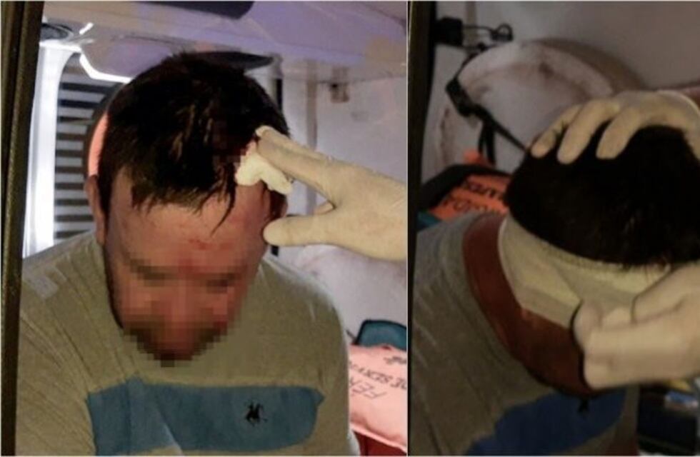 Lo atropellaron jinetes a caballo y lo abandonaron herido