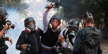 TOPSHOT - Venezuelan VPITV journalist Gregory Jaimes (C) is assisted by colleagues after being injured during clashes between anti-government protesters and security forces on the commemoration of May Day on May 1, 2019, after a day of violent clashes on the streets of the capital spurred by Venezuela's opposition leader Juan Guaido's call on the military to rise up against President Nicolas Maduro\u002E - Guaido called for a massive May Day protest to increase the pressure on Venezuelan President Nicolas Maduro\u002E (Photo by Federico Parra / AFP)