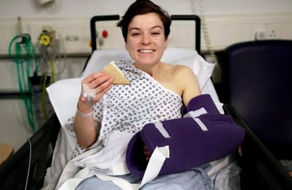 Se salpicó con limpiahornos y casi pierde su brazo izquierdo