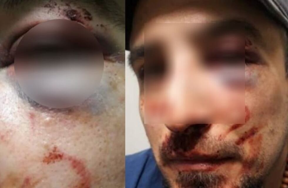 Desafectan a 4 policías por la denuncia de un joven bahiense