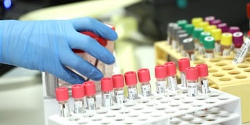 (Foto: Ilustrativa\u002E Créditos: ANSA / MATTEO BAZZI)