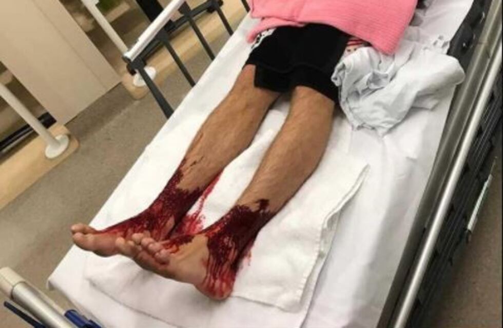 Misteriosas criaturas marinas le devoraron las piernas a un adolescente