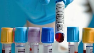 Los bioquímicos anunciaron que cobrarán un copago a los pacientes de las prepagas. Foto: Archivo