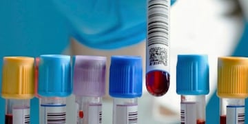 Los bioquímicos anunciaron que cobrarán un copago a los pacientes de las prepagas. Foto: Archivo