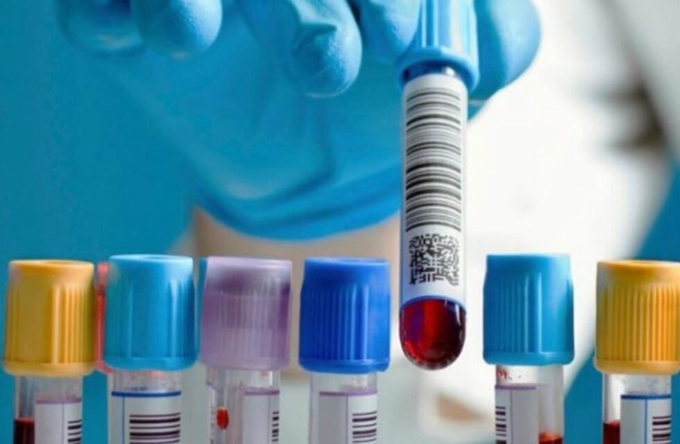 Bioquímicos anunciaron que cobrarán un copago a los pacientes de las prepagas: de cuánto sería el monto