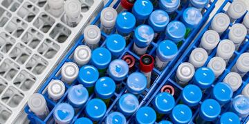 FILE PHOTO: Samples are logged at RealTime Laboratories before testing for the coronavirus disease (COVID-19) in Carrollton, Texas, U\u002ES\u002E June 24, 2020\u002E REUTERS/Cooper Neill/File Photo