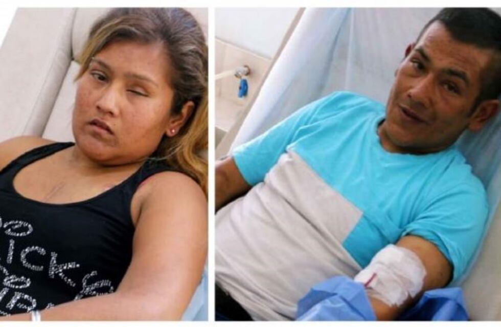 Ella es ciega, a él le cortaron una pierna y necesitan ayuda