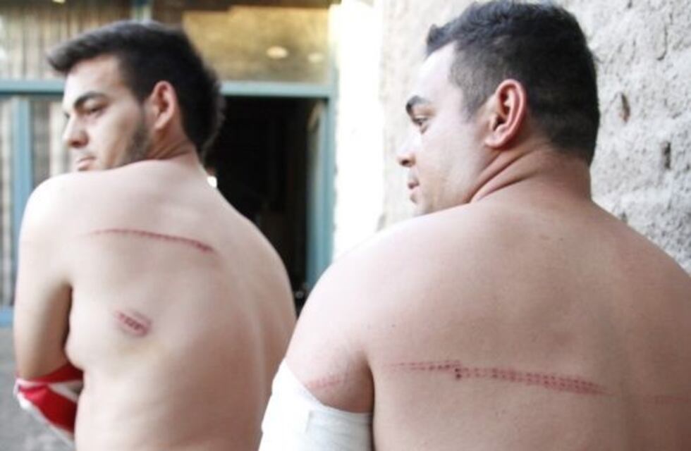 Furioso por la derrota, hincha de Boca golpeó y baleó a dos vecinos