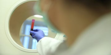 Imágen ilustrativa\u002E