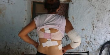 La mujer acaba de salir de Terapia Intensiva y está en su casa\u002E