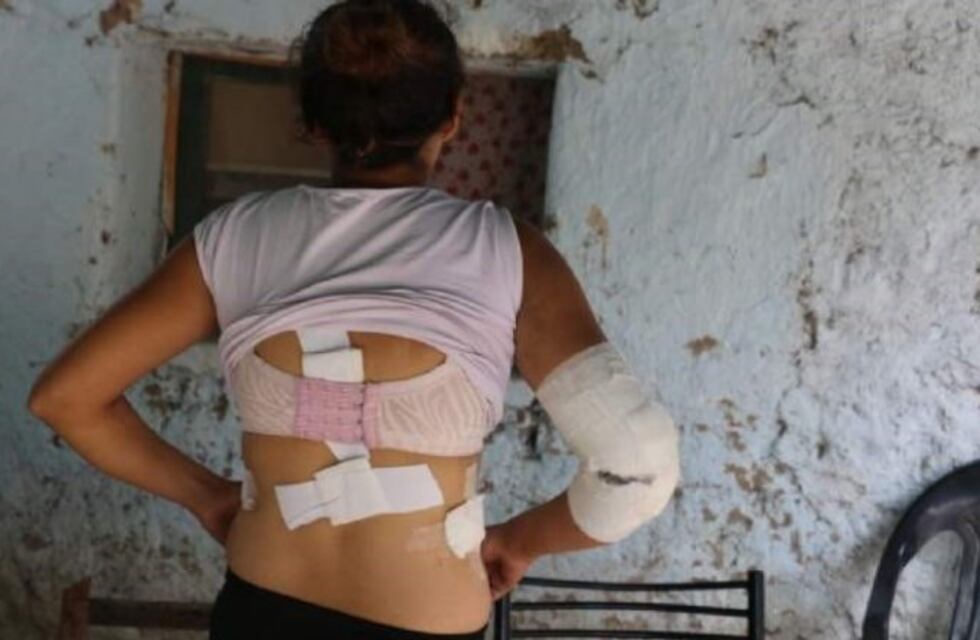 Su ex la apuñaló el día de su cumpleaños: "No va a parar hasta que me mate"