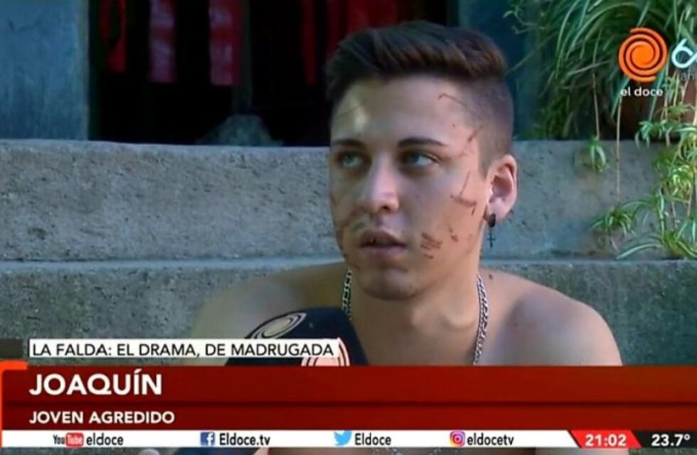 "Le dijimos a policías y nos dijeron que nos fuéramos tranquilos", contó el joven atacado en patota
