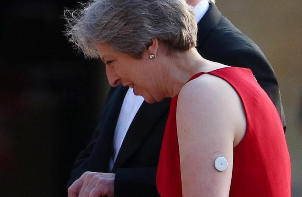 Qué es el "botón blanco" que tiene Theresa May en el brazo