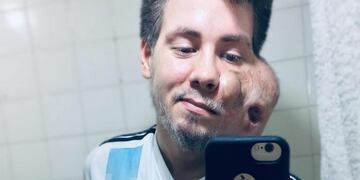 Sebastián Amurín D’Amico padece un sarcoma embrionario en el maxilar derecho y será operado en Mendoza (Foto: Instagram)