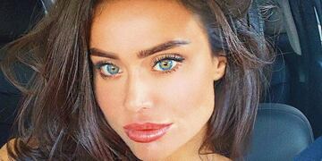 Una modelo rusa murió tras inyectarse un tratamiento recomendado por Miley Cyrus