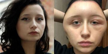 Estelle quiso cambiar su look y quedó desfigurada