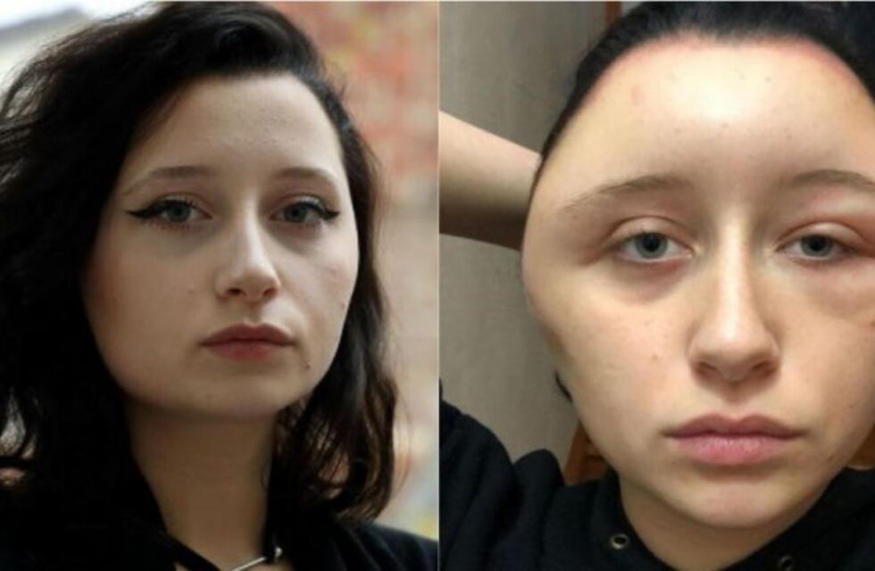 Quiso cambiar su look y quedó desfigurada