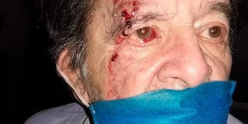 Jubilado agredido por un guardia\u002E