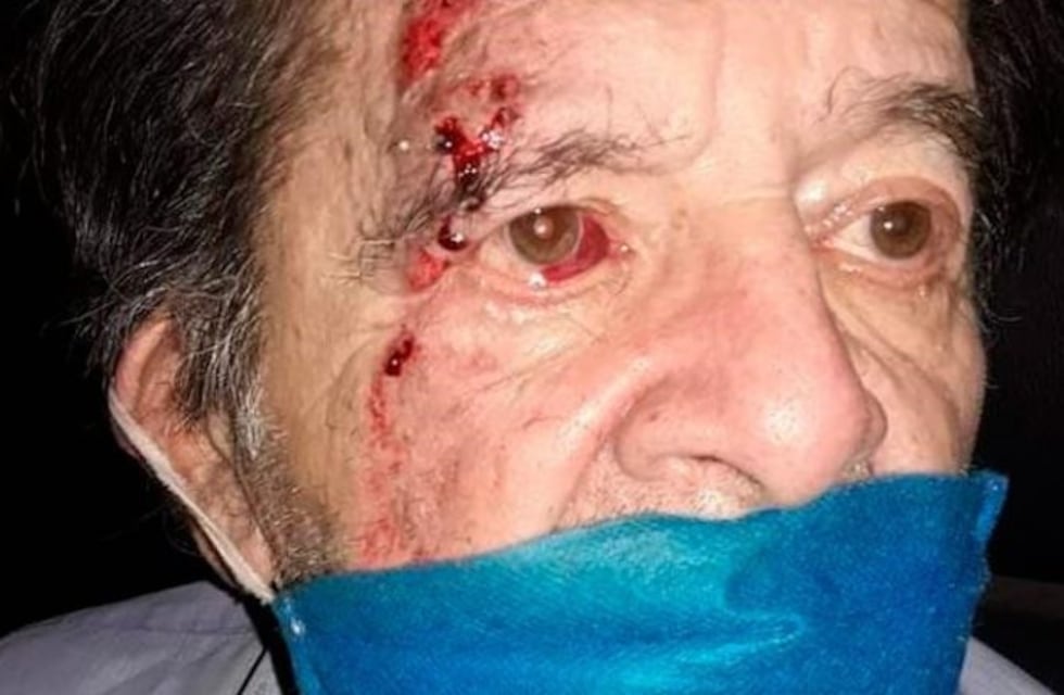 Brutal golpiza a un jubilado por parte de un guardia de seguridad de un supermercado en Córdoba
