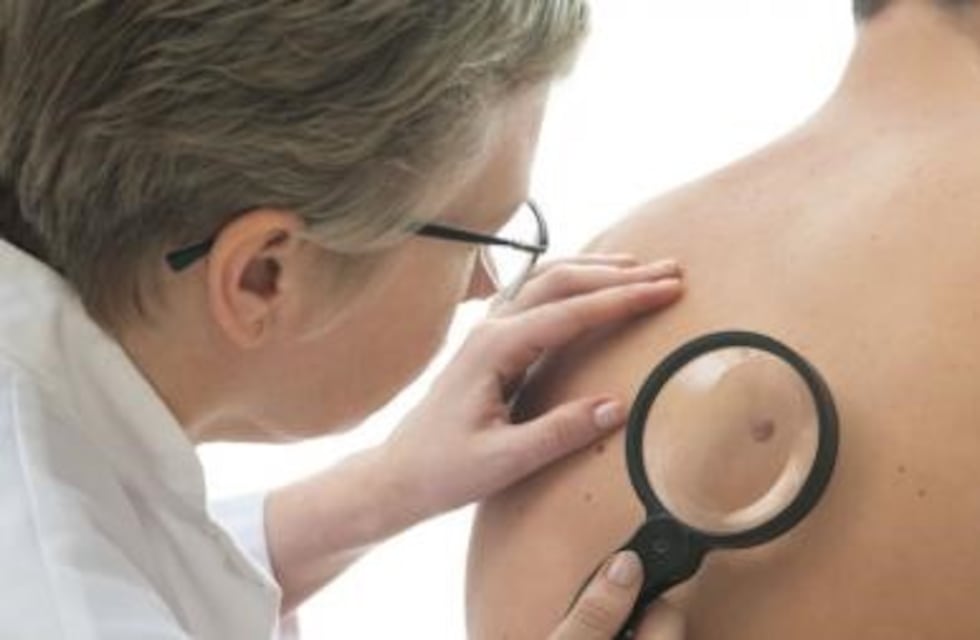Campaña de Detección de Cancer de Piel en Punta Alta