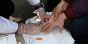 La mayoría de los casos se dieron por mantener relaciones sin preservativo\u002E (AP Photo/Vahid Salemi)