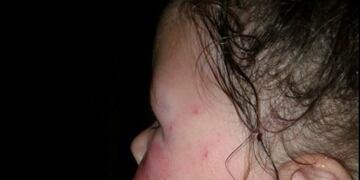 Briana, la nena que recibió una golpiza por parte de su padrastro\u002E