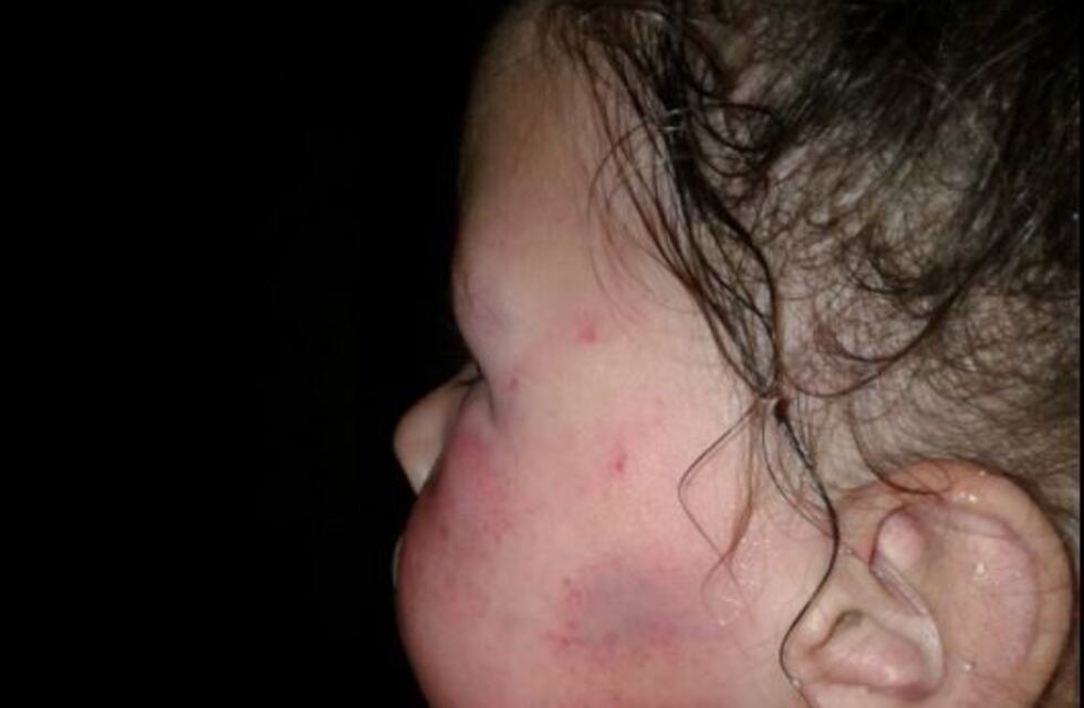 Violencia familiar en La Plata: un hombre golpeó brutalmente a una nena de 3 años