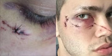 Marcos Zalazar y Franco de Bernardo fueron agredidos en Palermo (Web)