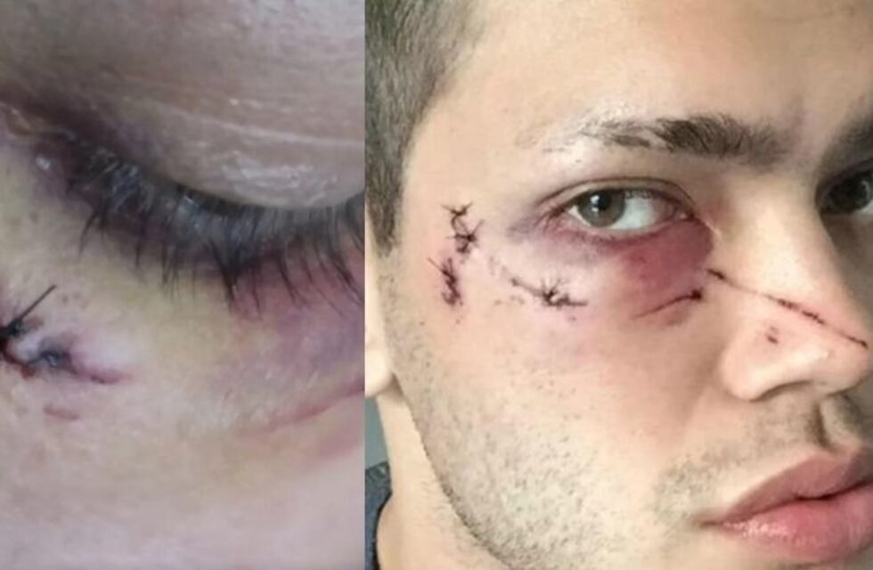 Ataque homofóbico en Palermo: un hombre golpeó brutalmente a dos jóvenes mientras desayunaban