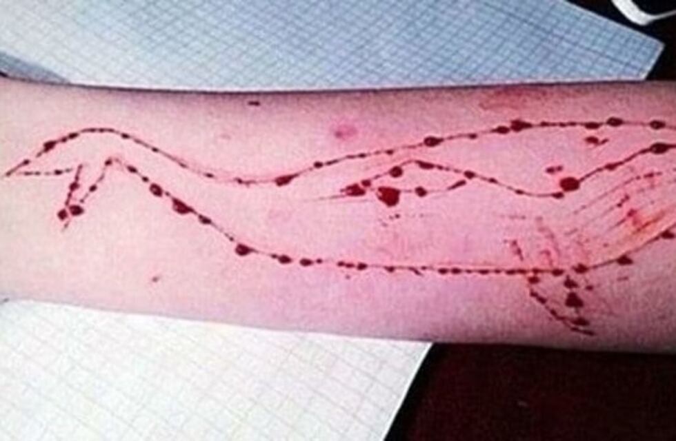 La Justicia de San Luis quiere dictar un protocolo de prevención contra el desafío de la "ballena azul"