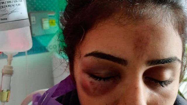 La joven agredida registra lesiones severas en la cabeza y en el cuerpo.