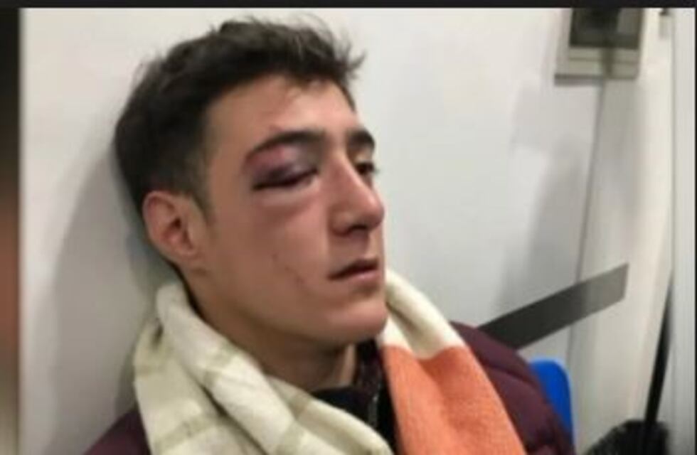 Estacionó el auto en un lugar reservado y le pegaron un ladrillazo en la cara