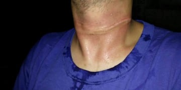 Un cable a baja altura en una calle con mucha circulación casi termina en tragedia